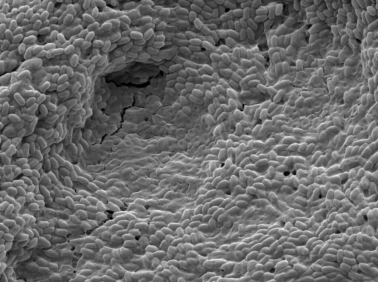 Black and white microscopic image that looks like a tunnel covered in cells.